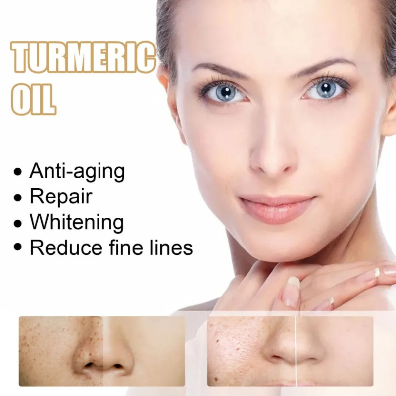 EELHOE TURMERIC OIL...