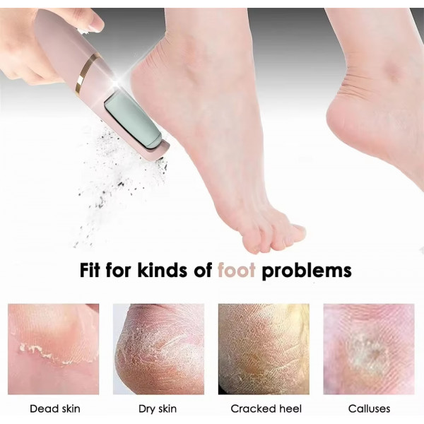 New Electronic Pedicure Tool