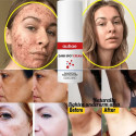 Dark Spot Cream