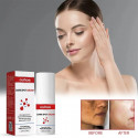 Dark Spot Cream