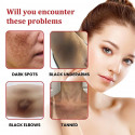 Dark Spot Cream