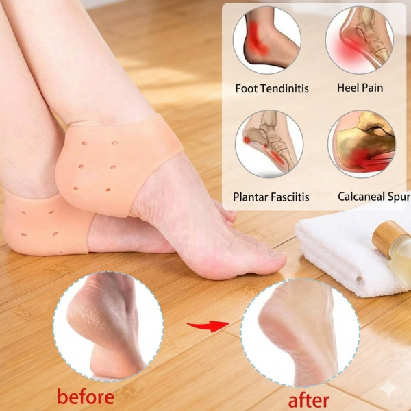 Silicone Heel anti-Crack Sets